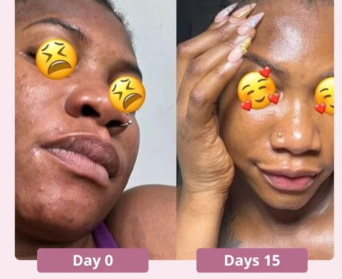 Turmeric & Kojic Acid Soap