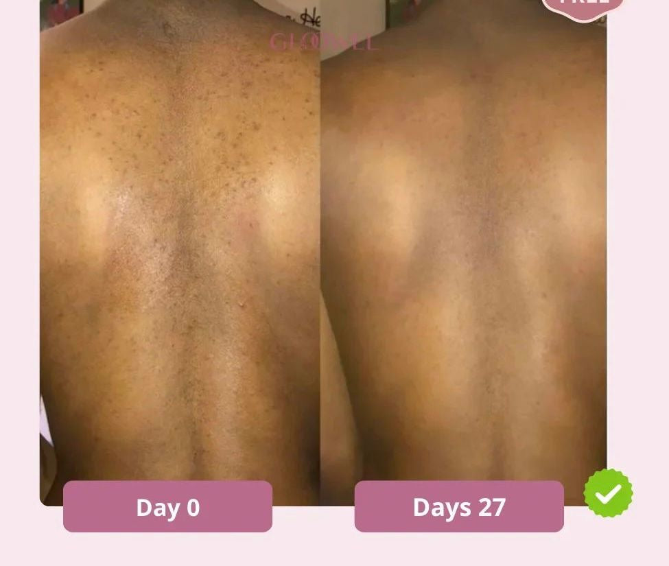 Turmeric & Kojic Acid Soap (3)